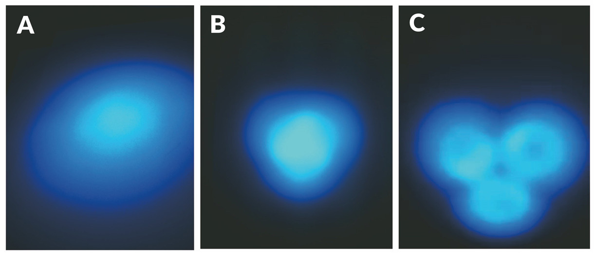 Comparison of spot displays by different led black lights